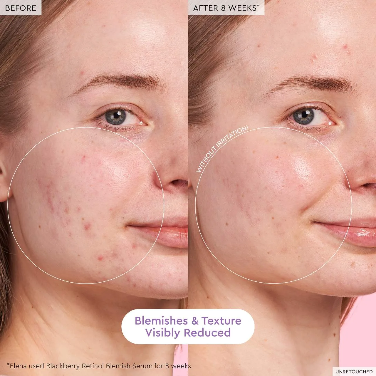 BLACKBERRY_SERUM_B&A_ELENA_2000x2000