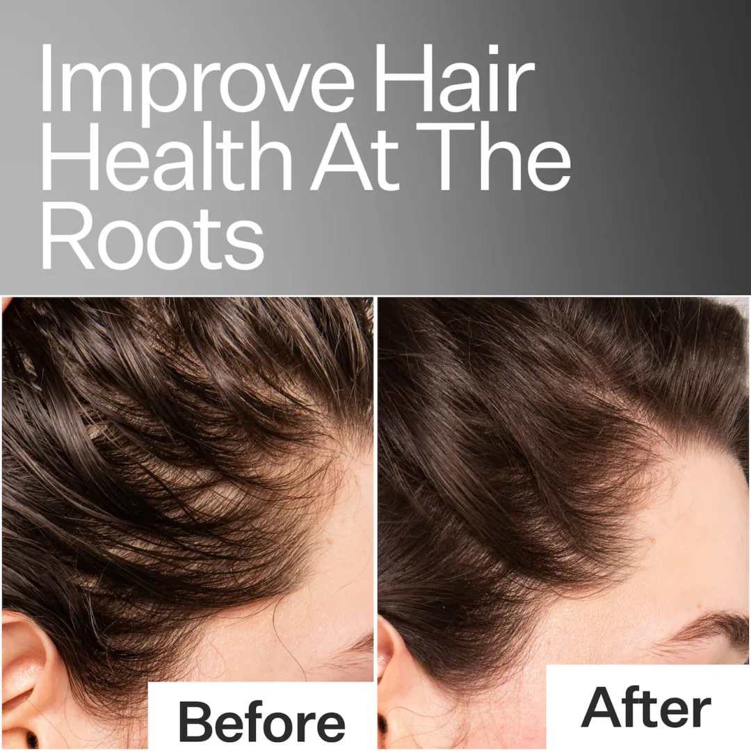 Scalp Relief System Set