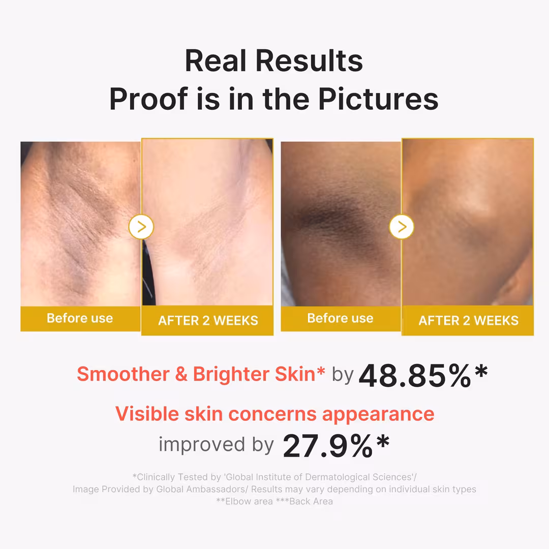 Kojic Acid Turmeric Body Peel Shot